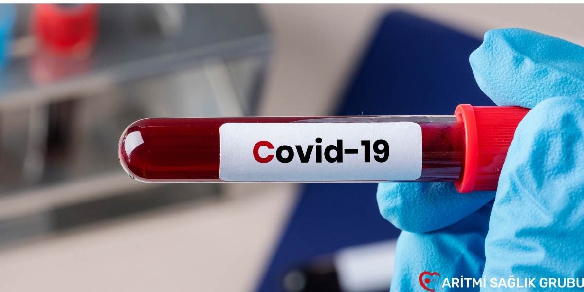 Covid-19 testi kan tahlili nasıl yapılır