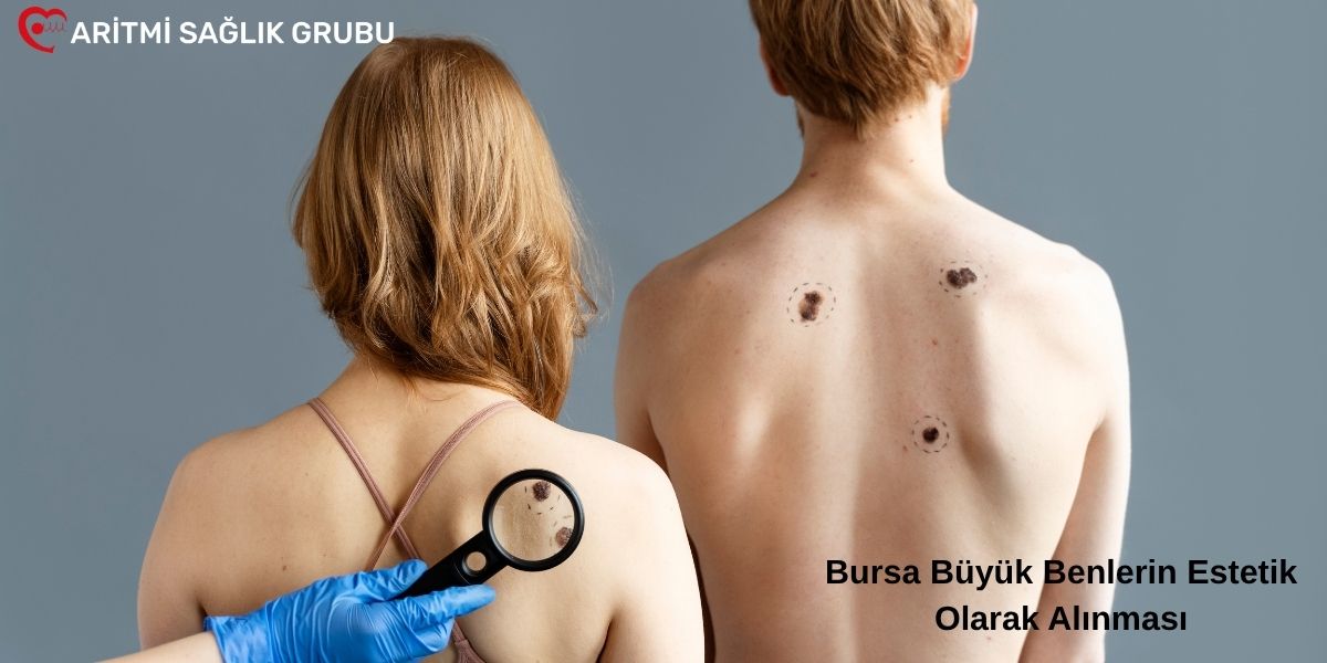Büyük ben estetistiği