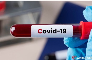 2025 Covid-19 Etkileri