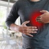 Gastroözofageal Reflü Nedir?