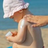 Güneş Yanığına Ne İyi Gelir? Güneş Yanıkları Nasıl Geçer? 