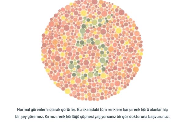 renk-korlugu-tedavisi